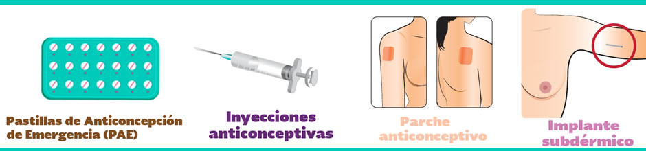 Métodos Anticonceptivos | Instituto de Salud del Estado de México